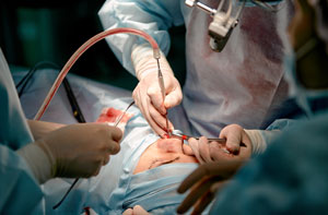 Rhinoplasty Surgeon Watford Hertfordshire Rhinoplasty Surgeon Watford Hertfordshire or Near Me