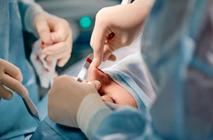Rhinoplasty Near Me Watford Hertfordshire Rhinoplasty Near Me Watford