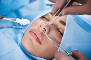 Rhinoplasty Surgery Ossett UK